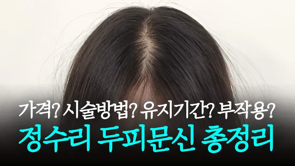 정수리 두피문신을 안전하게 하는 방법과 가격 유지기간 부작용 완벽 가이드